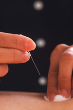 acupuncture image